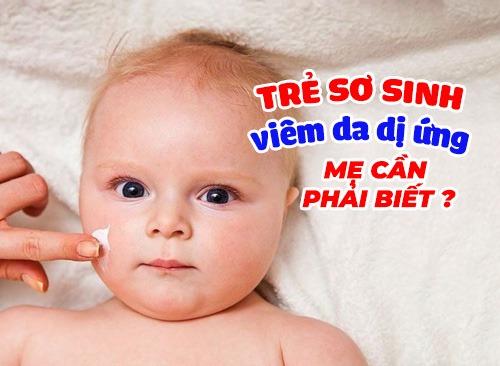 Trẻ Sơ Sinh Bị Viêm Da Dị Ứng: Mách Mẹ Cách Giải Quyết 