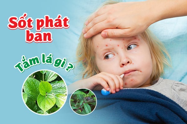 Sốt Phát Ban Tắm Lá Gì Cho Trẻ Để Nhanh Khỏi Bệnh?